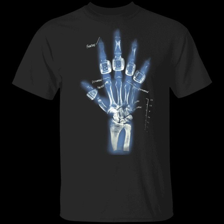 Kobe X Ray Shirt Vintage Kobe Bryant Hand X-Ray Ring T-Shirt Gifts For Basketball Fans Kobe X Ray Shirt Vintage Kobe Bryant Hand X-Ray Ring T-Shirt Gifts For Basketball Fans